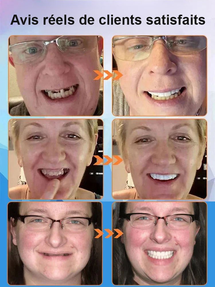 Nouvelle découverte britannique】Appareil dentaire en silicone imitant les dents