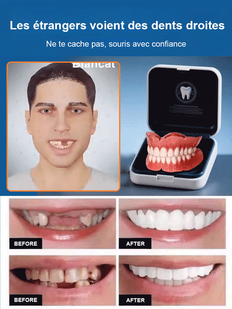 Nouvelle découverte britannique】Appareil dentaire en silicone imitant les dents