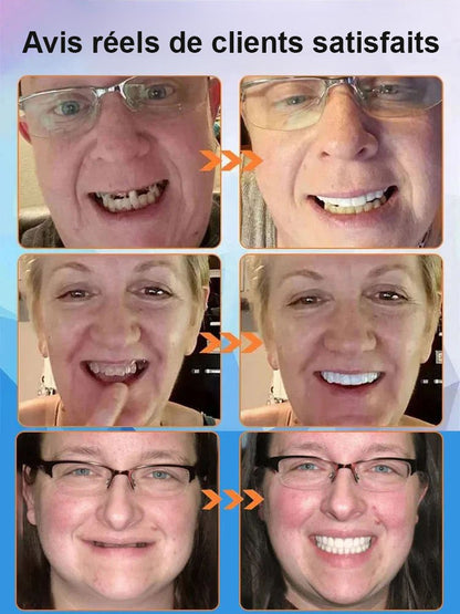 Nouvelle découverte britannique】Appareil dentaire en silicone imitant les dents