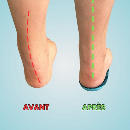 Semelles OrthoFlex™ - Une journée entière sans douleur