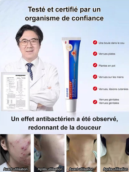 Gel médical antipyrétique Verrucoqingning